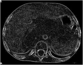 [Morphological gradient of 
greyscale image]