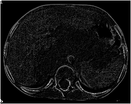 [Greyscale image after tophat
transform]