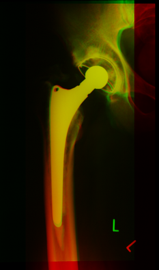 Test1_result.small.png