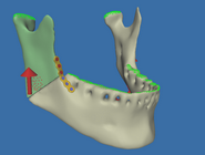 images/cmf/op6-002tn.png