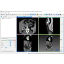 CT orvosi kép lágy szöveteket jól mutató részének megjelenítése (400 ablak és 100 szint értékkel).
